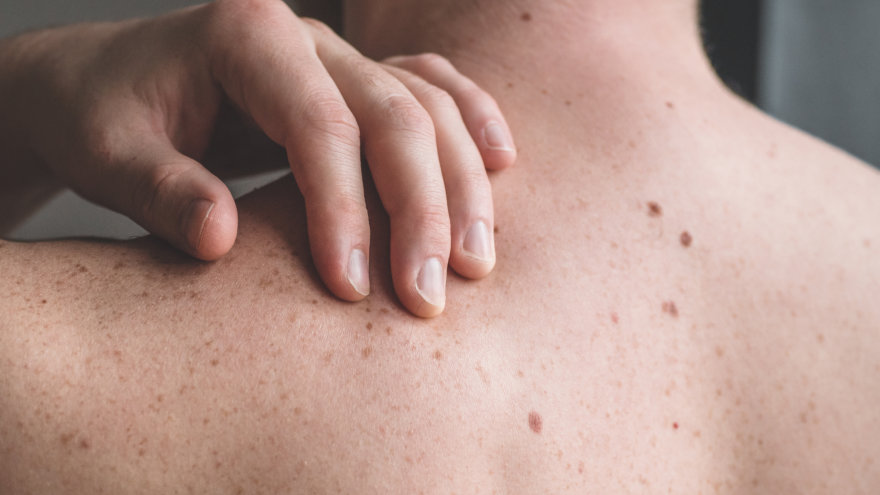 A man checking for abnormal moles on the middle of his back.